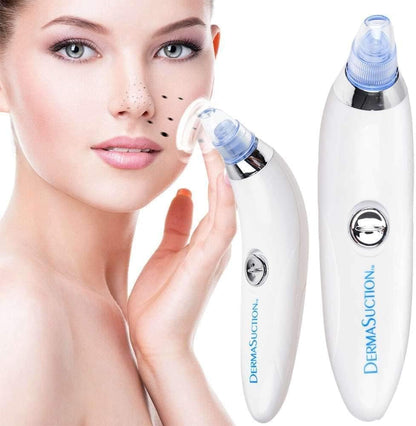 ✨ ClearSkin Pro™ Blackhead Remover Vacuum – Deep Pore Cleaning in Seconds ✨