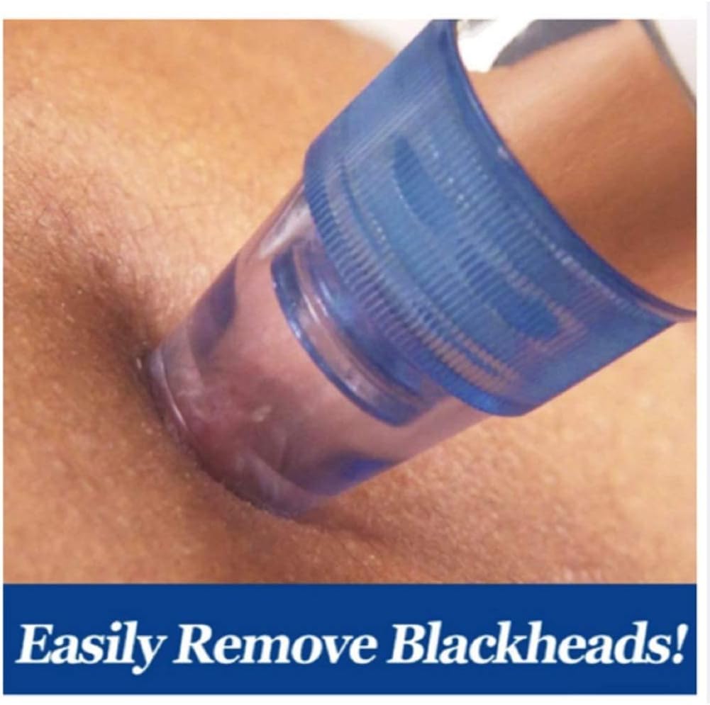 ✨ ClearSkin Pro™ Blackhead Remover Vacuum – Deep Pore Cleaning in Seconds ✨