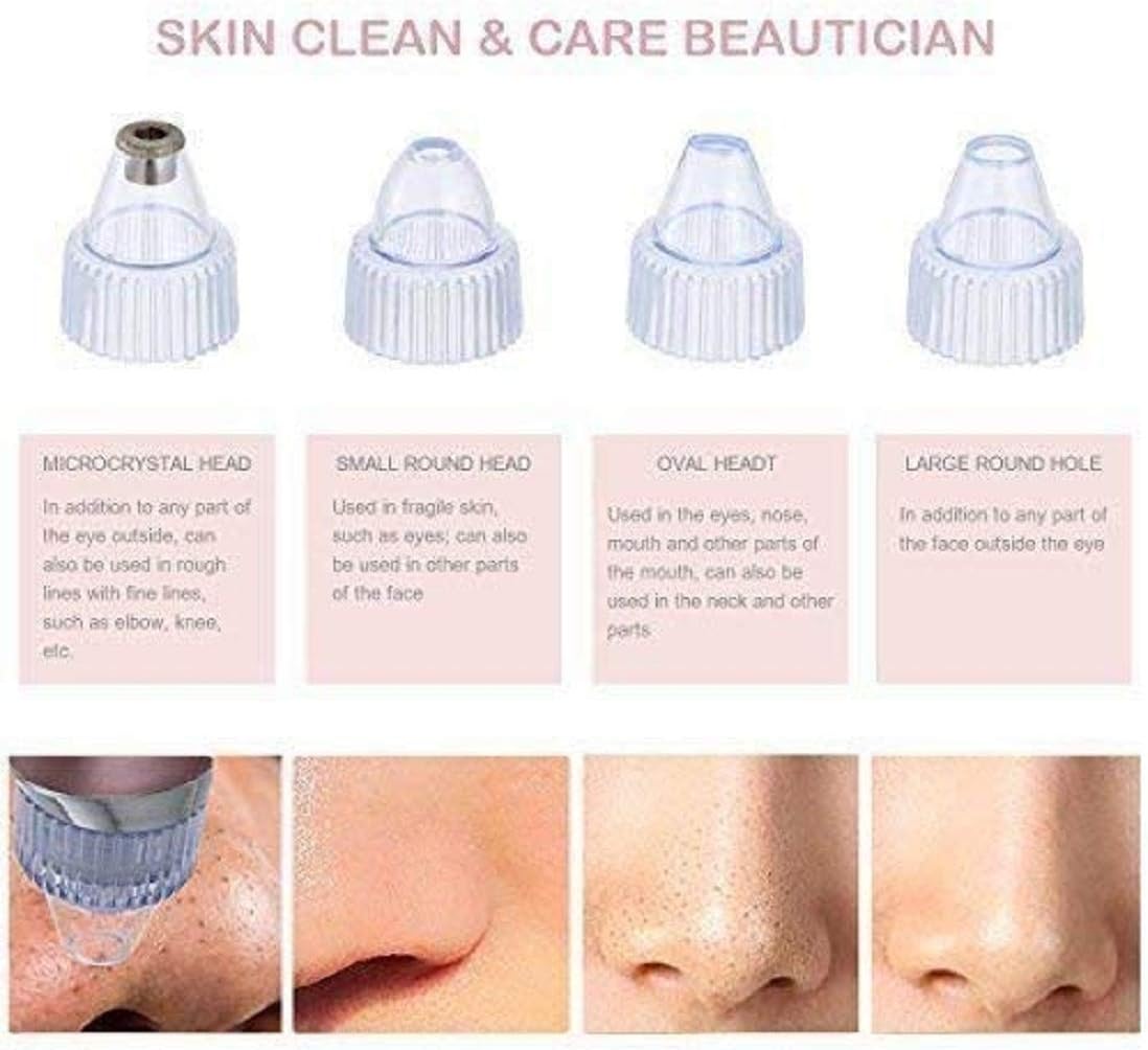 ✨ ClearSkin Pro™ Blackhead Remover Vacuum – Deep Pore Cleaning in Seconds ✨