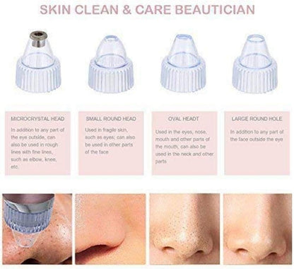 ✨ ClearSkin Pro™ Blackhead Remover Vacuum – Deep Pore Cleaning in Seconds ✨