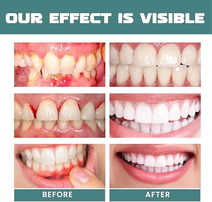 🌿 Eelhoe™ Herbal Mouth Relief Spray – Instant Gum & Oral Comfort (25ml)