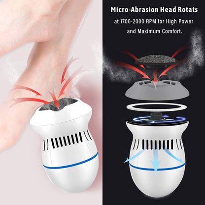 ✨ Electric Callus Remover – Smooth, Soft Feet in Minutes! ✨